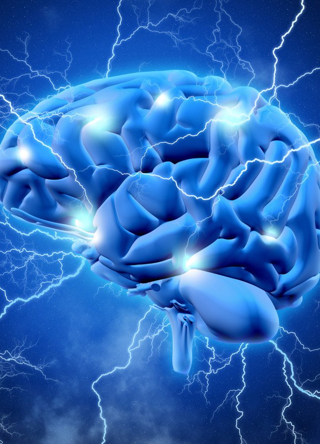 neurology-img